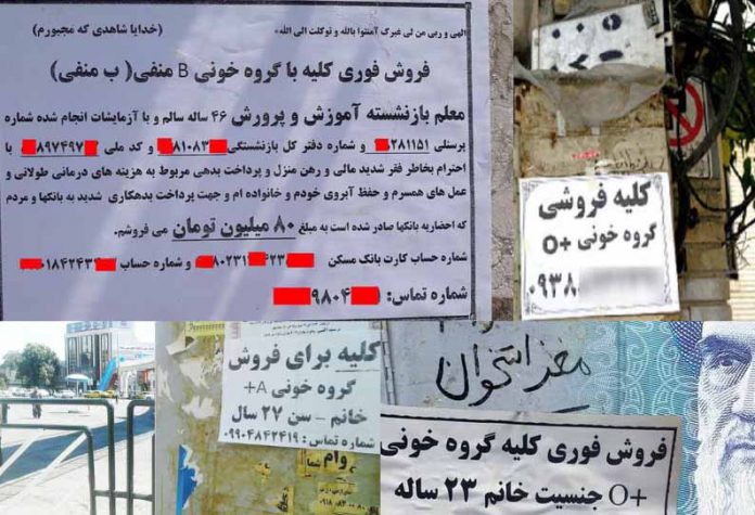 201909201605305878_Iran-horror-The-sick-black-market-where-you-can-sell-your_SECVPF